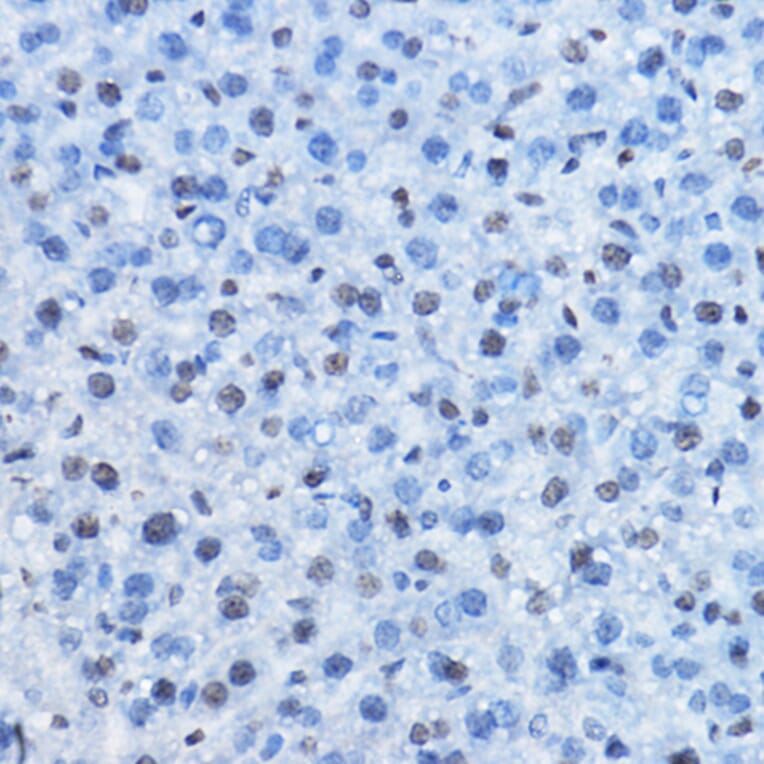 Immunohistochemistry - Anti-CBX3 Antibody (A329445) - Antibodies.com