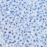 Immunohistochemistry - Anti-CBX3 Antibody (A329445) - Antibodies.com