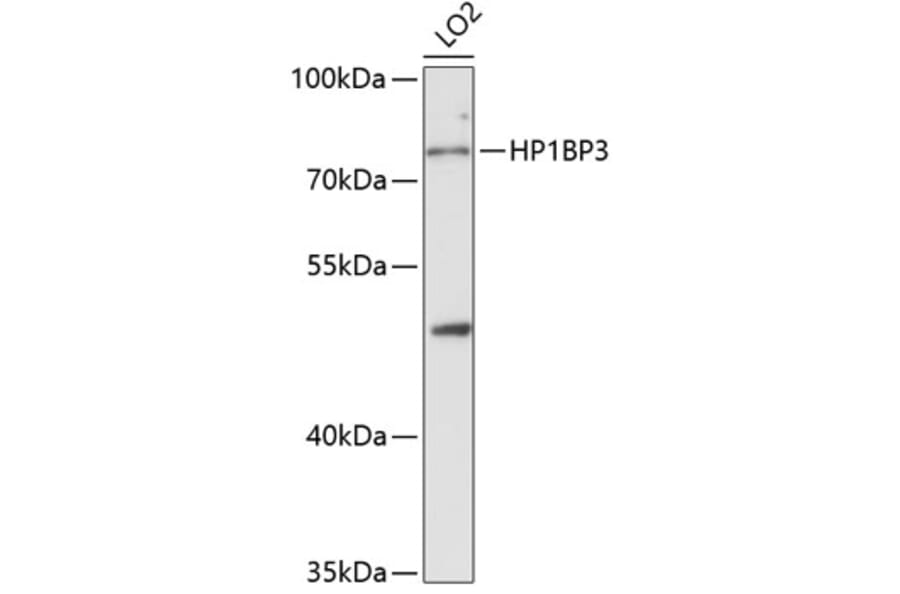 Western Blot - Anti-HP1BP3 Antibody (A329446) - Antibodies.com