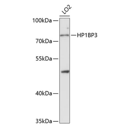 Western Blot - Anti-HP1BP3 Antibody (A329446) - Antibodies.com