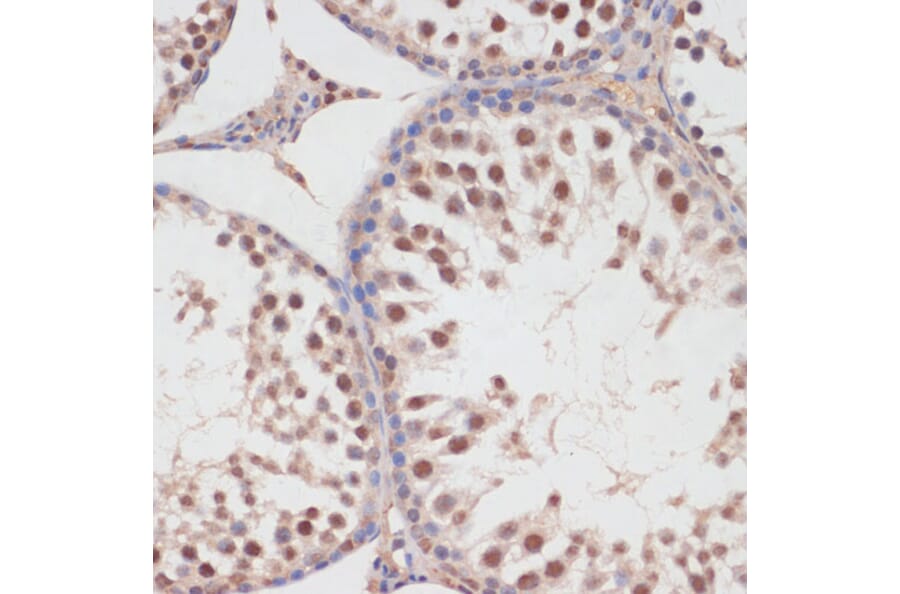 Immunohistochemistry - Anti-HP1BP3 Antibody (A329446) - Antibodies.com