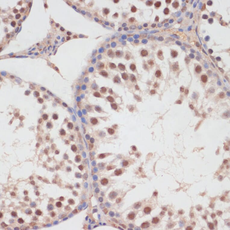 Immunohistochemistry - Anti-HP1BP3 Antibody (A329446) - Antibodies.com