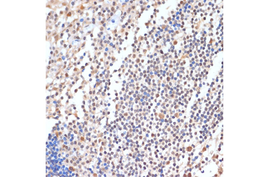 Immunohistochemistry - Anti-HP1BP3 Antibody (A329446) - Antibodies.com