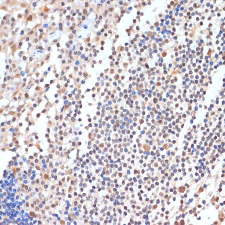 Immunohistochemistry - Anti-HP1BP3 Antibody (A329446) - Antibodies.com