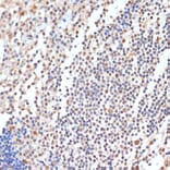 Immunohistochemistry - Anti-HP1BP3 Antibody (A329446) - Antibodies.com