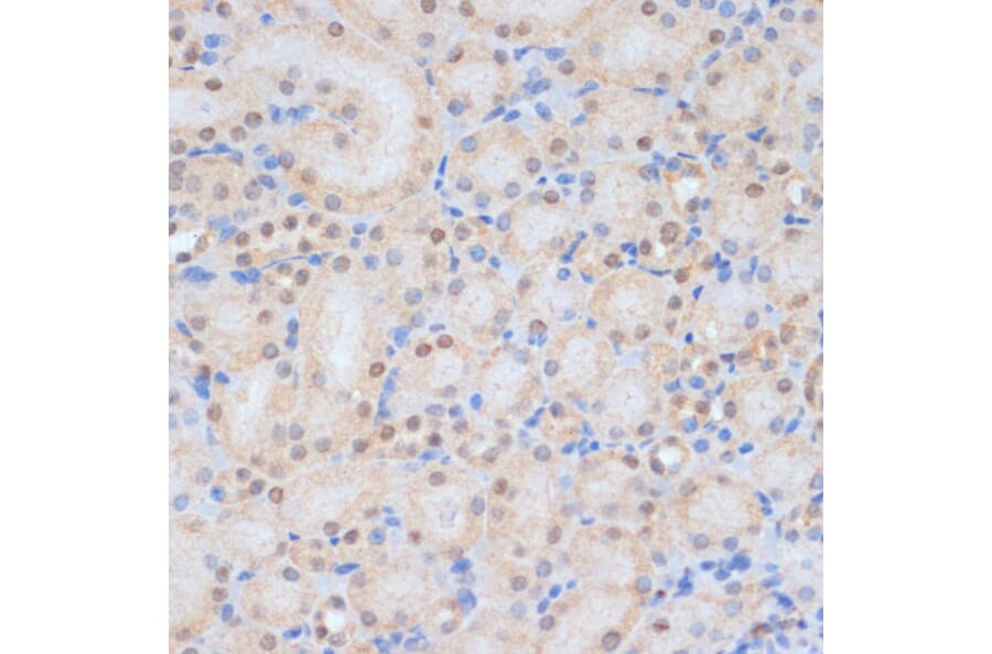 Immunohistochemistry - Anti-HP1BP3 Antibody (A329446) - Antibodies.com