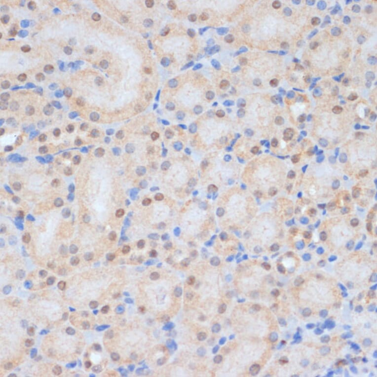 Immunohistochemistry - Anti-HP1BP3 Antibody (A329446) - Antibodies.com