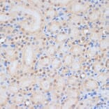 Immunohistochemistry - Anti-HP1BP3 Antibody (A329446) - Antibodies.com