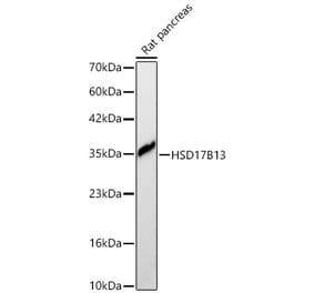 Western Blot - Anti-HSD17B13 Antibody (A329447) - Antibodies.com