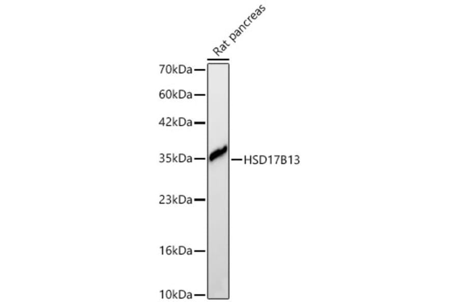 Western Blot - Anti-HSD17B13 Antibody (A329447) - Antibodies.com