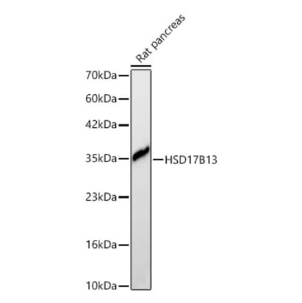 Western Blot - Anti-HSD17B13 Antibody (A329447) - Antibodies.com