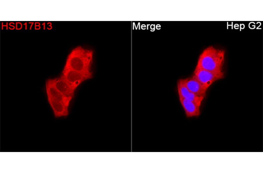 Immunofluorescence - Anti-HSD17B13 Antibody (A329447) - Antibodies.com