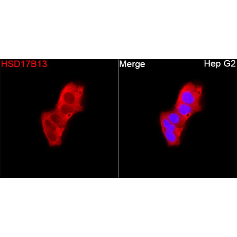 Immunofluorescence - Anti-HSD17B13 Antibody (A329447) - Antibodies.com