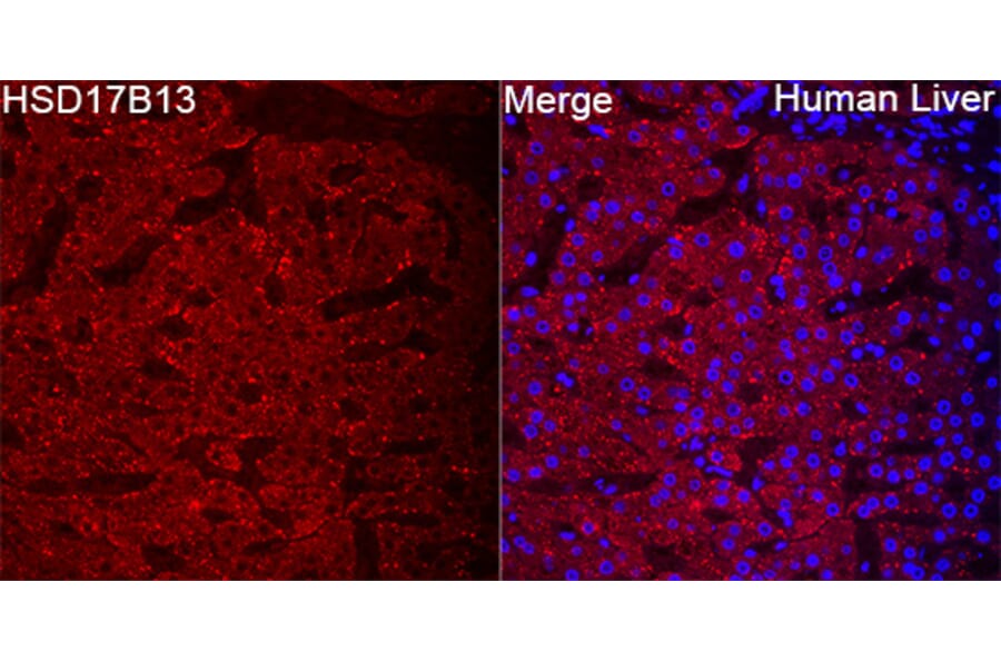 Immunofluorescence - Anti-HSD17B13 Antibody (A329447) - Antibodies.com