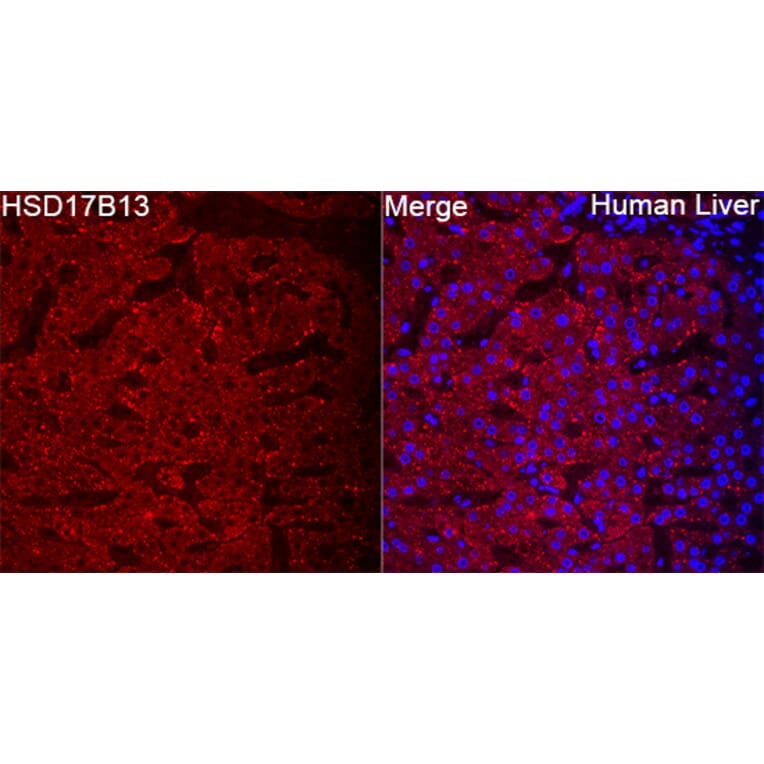 Immunofluorescence - Anti-HSD17B13 Antibody (A329447) - Antibodies.com