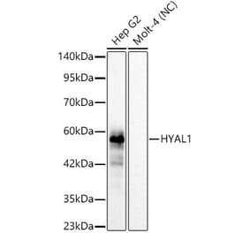 Western Blot - Anti-HYAL1 Antibody [ARC62100] (A329449) - Antibodies.com