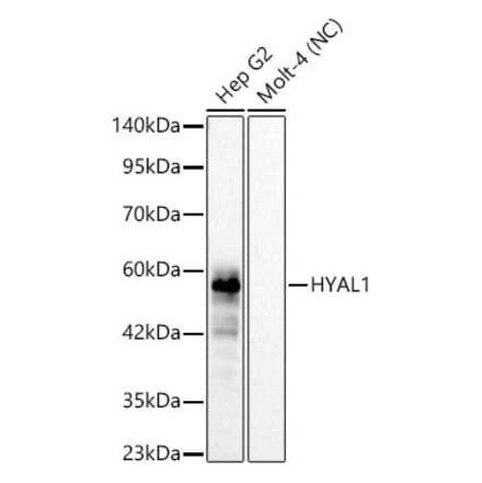 Western Blot - Anti-HYAL1 Antibody [ARC62100] (A329449) - Antibodies.com