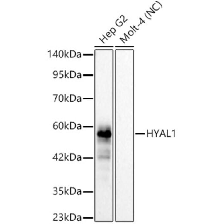 Western Blot - Anti-HYAL1 Antibody [ARC62100] (A329449) - Antibodies.com