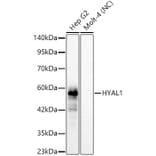 Western Blot - Anti-HYAL1 Antibody [ARC62100] (A329449) - Antibodies.com