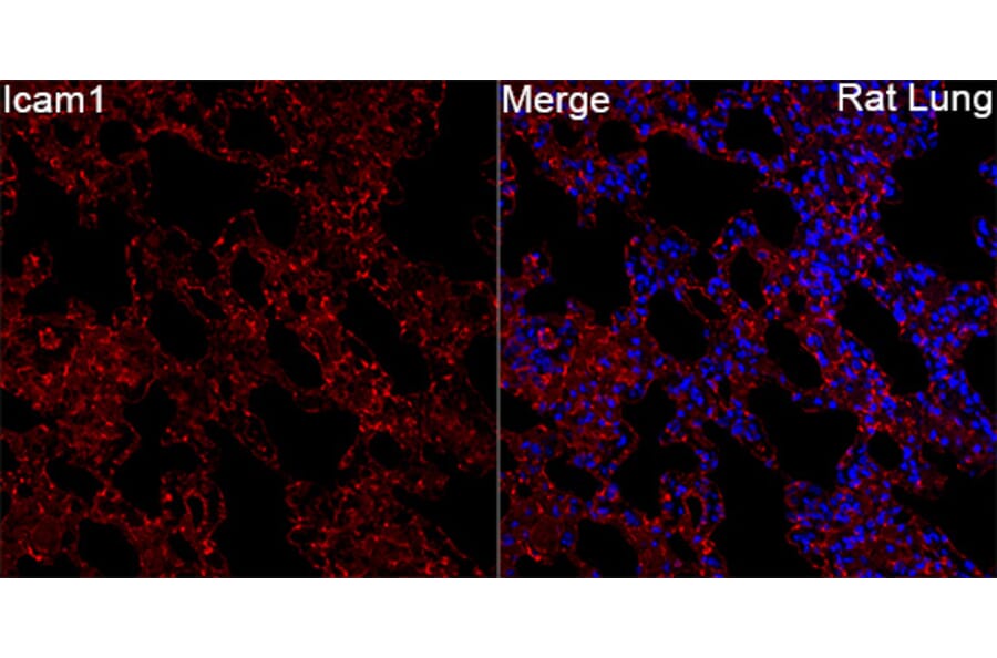 Immunofluorescence - Anti-Icam1 Antibody (A329454) - Antibodies.com