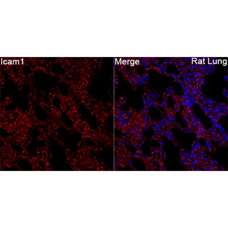 Immunofluorescence - Anti-Icam1 Antibody (A329454) - Antibodies.com