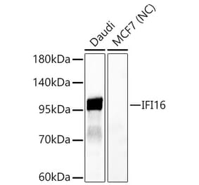 Western Blot - Anti-IFI16 Antibody (A329458) - Antibodies.com