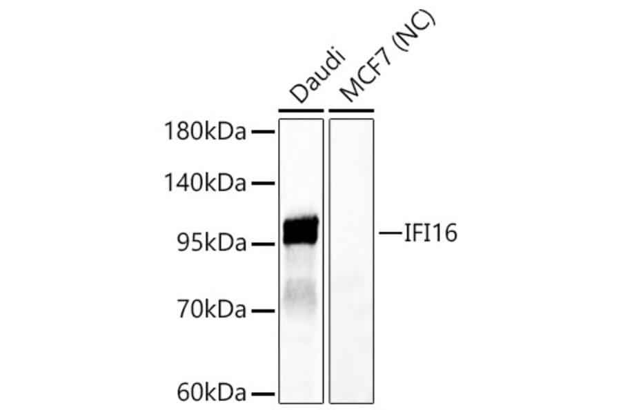 Western Blot - Anti-IFI16 Antibody (A329458) - Antibodies.com