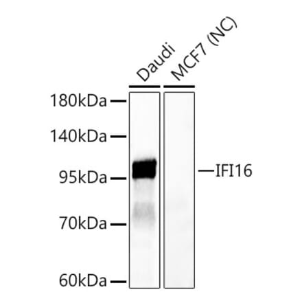 Western Blot - Anti-IFI16 Antibody (A329458) - Antibodies.com