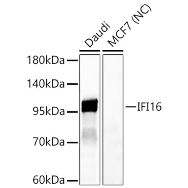 Western Blot - Anti-IFI16 Antibody (A329458) - Antibodies.com