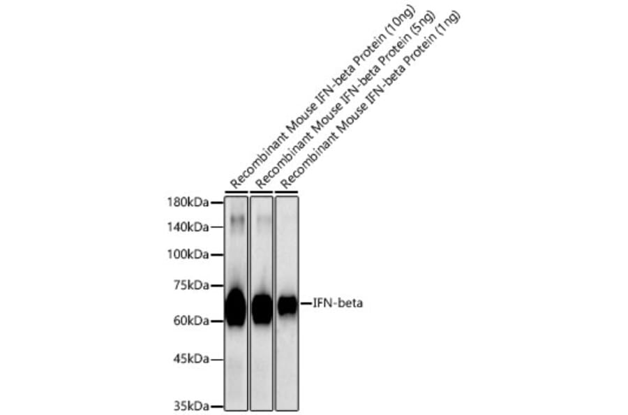 Western Blot - Anti-IFN beta Antibody (A329459) - Antibodies.com