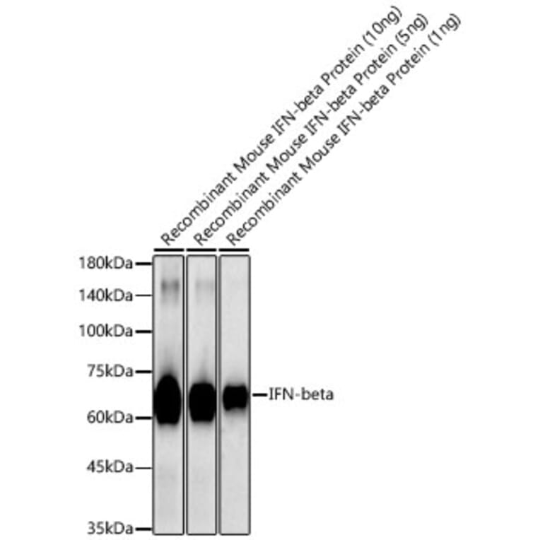 Western Blot - Anti-IFN beta Antibody (A329459) - Antibodies.com