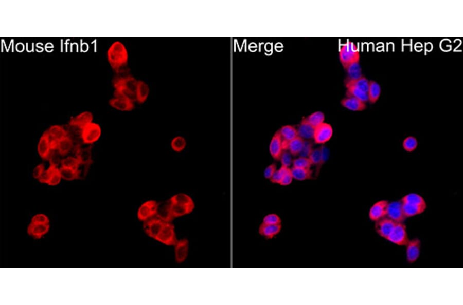 Immunofluorescence - Anti-IFN beta Antibody (A329459) - Antibodies.com