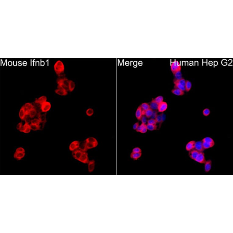 Immunofluorescence - Anti-IFN beta Antibody (A329459) - Antibodies.com