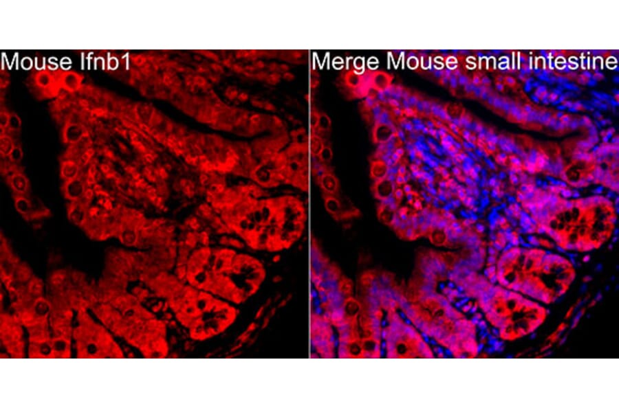 Immunofluorescence - Anti-IFN beta Antibody (A329459) - Antibodies.com
