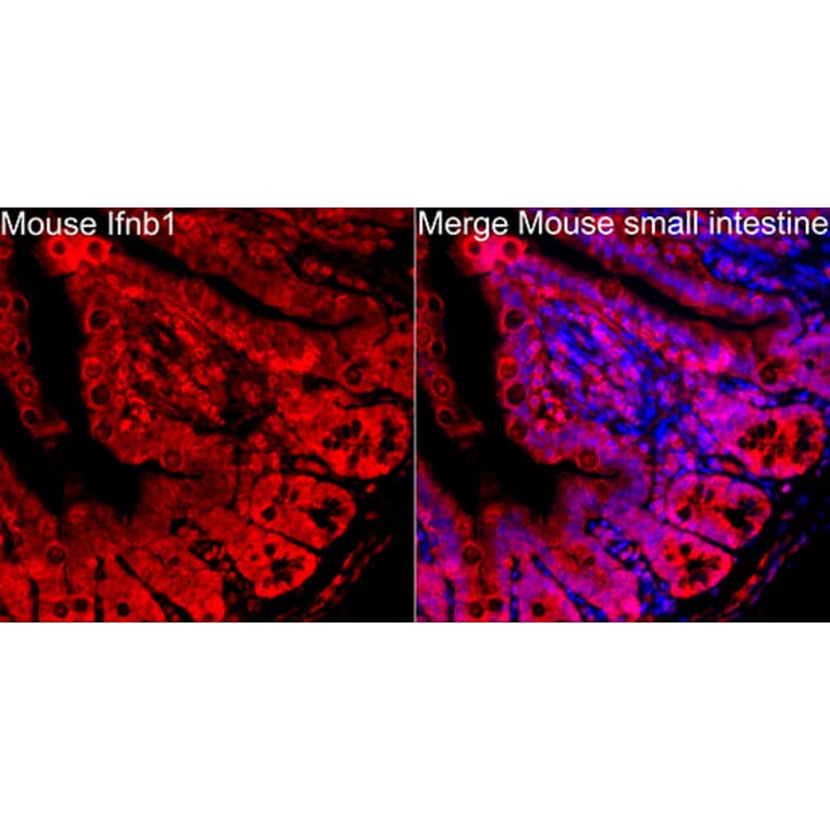 Immunofluorescence - Anti-IFN beta Antibody (A329459) - Antibodies.com