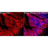Immunofluorescence - Anti-IFN beta Antibody (A329459) - Antibodies.com