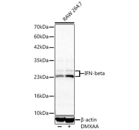 Western Blot - Anti-IFN beta Antibody [ARC68043] (A329460) - Antibodies.com