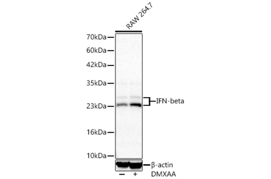 Western Blot - Anti-IFN beta Antibody [ARC68043] (A329460) - Antibodies.com
