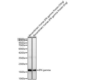 Western Blot - Anti-IFN gamma Antibody [ARC52882] (A329461) - Antibodies.com