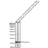 Western Blot - Anti-IFN gamma Antibody [ARC52882] (A329461) - Antibodies.com