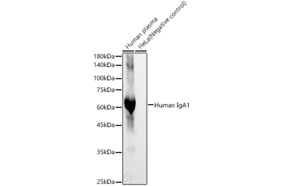 Western Blot - Anti-IgA1 Antibody [ARC60394] (A329464) - Antibodies.com