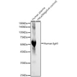 Western Blot - Anti-IgA1 Antibody [ARC60394] (A329464) - Antibodies.com