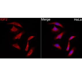 Immunofluorescence - Anti-IGF2 Antibody (A329466) - Antibodies.com