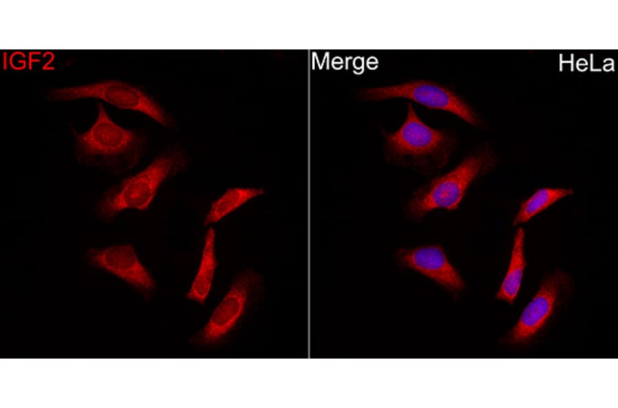 Immunofluorescence - Anti-IGF2 Antibody (A329466) - Antibodies.com