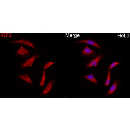 Immunofluorescence - Anti-IGF2 Antibody (A329466) - Antibodies.com