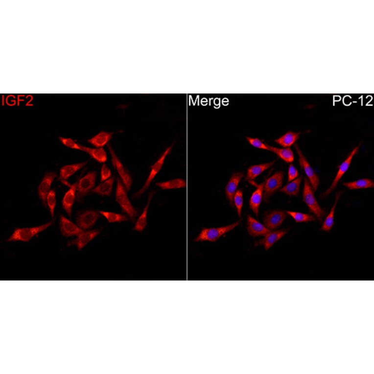 Immunofluorescence - Anti-IGF2 Antibody (A329466) - Antibodies.com