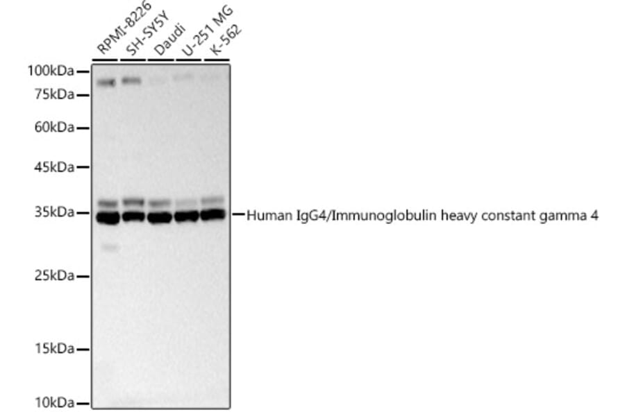 Western Blot - Anti-IgG4 Antibody (A329472) - Antibodies.com