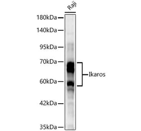 Western Blot - Anti-Ikaros Antibody (A329475) - Antibodies.com