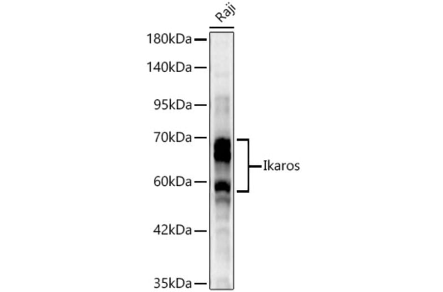 Western Blot - Anti-Ikaros Antibody (A329475) - Antibodies.com