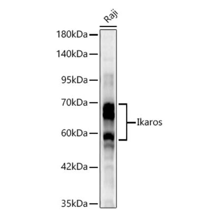 Western Blot - Anti-Ikaros Antibody (A329475) - Antibodies.com
